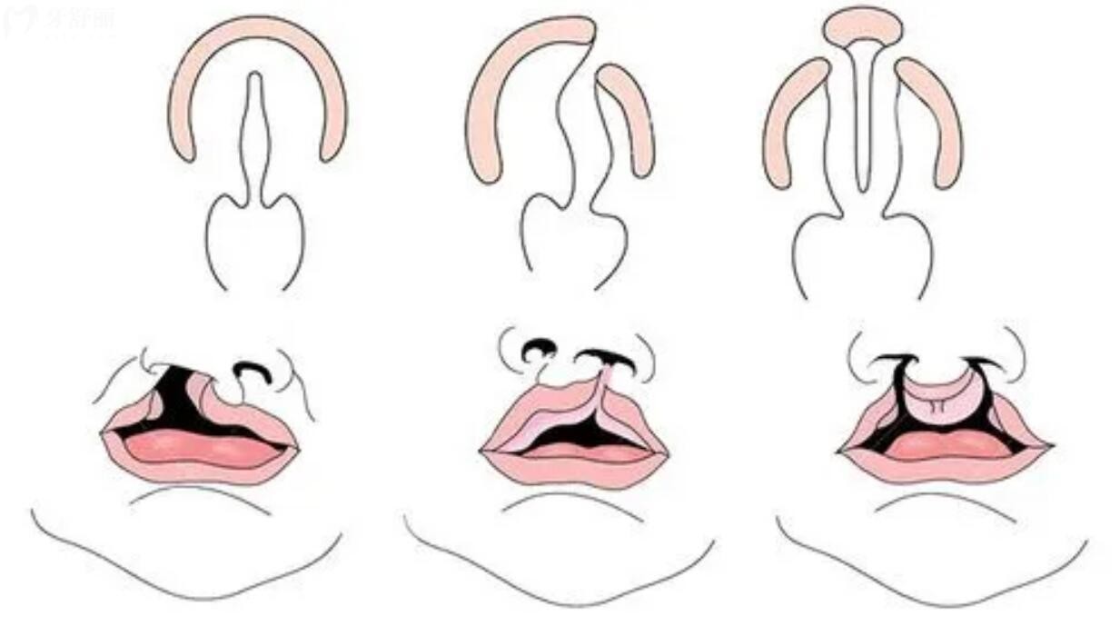 16693696116994951.jpg 16693696116994951.jpg